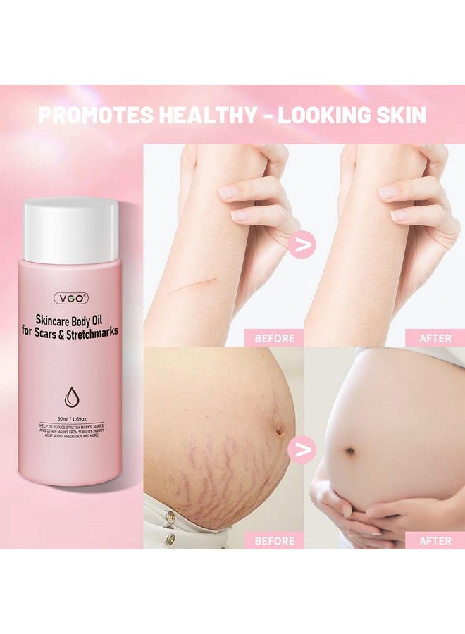 VGO Skincare Body Oil for women, Vitamin E Oil for Scars Away, Stretch Mark Oil for All Skin Types, 50ml / 1.69oz - Image 2