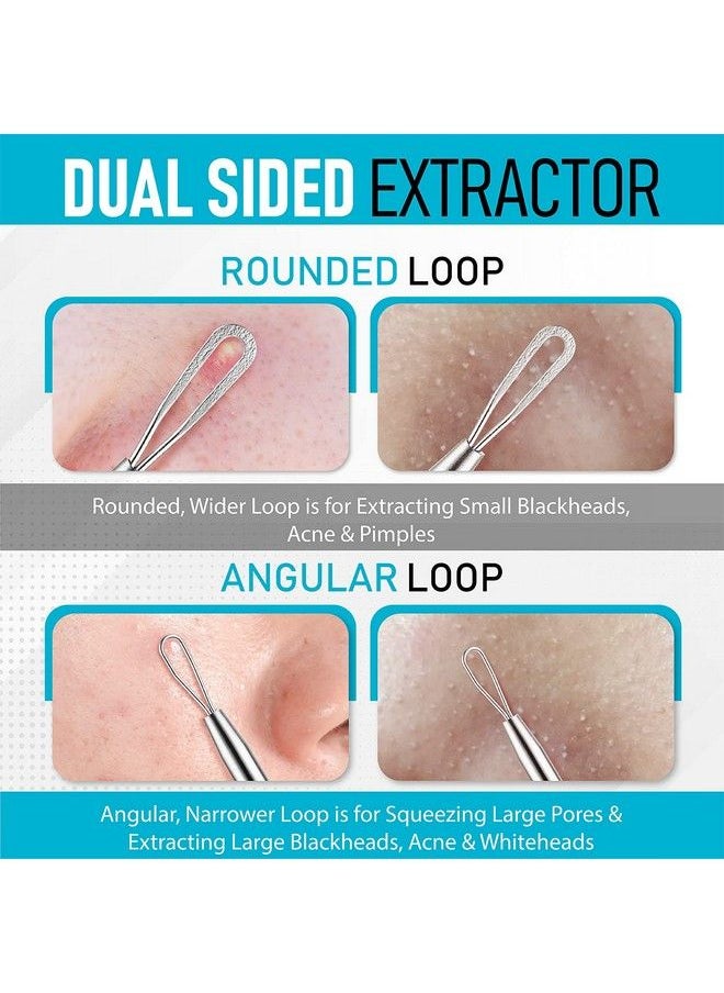 Hula Home - Blackhead Remover Pimple Extractor Popper Tool Acne Comedone Blackhead Blemish Whitehead Popping Zit Removing For Nose Face 304 Stainless Steel - Image 1