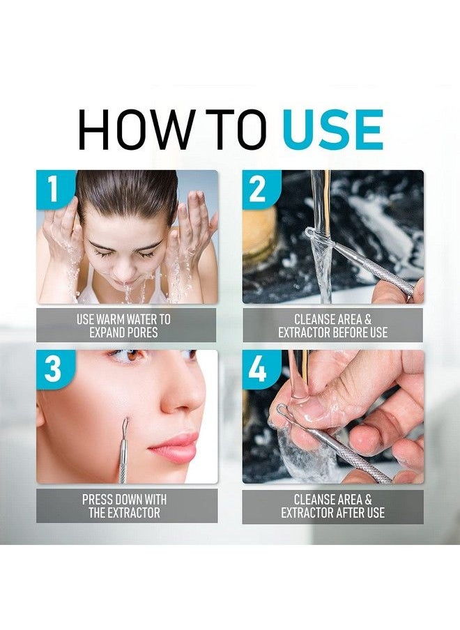 Hula Home - Blackhead Remover Pimple Extractor Popper Tool Acne Comedone Blackhead Blemish Whitehead Popping Zit Removing For Nose Face 304 Stainless Steel - Image 1