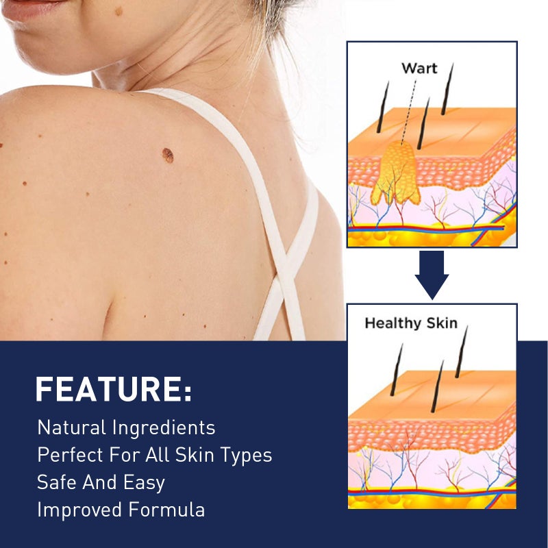 EELHOE 144PCS Skin Tag Patches Fast Healing Mole Wart Remover Waterproof Non-drying for All Skin Type - Image 4