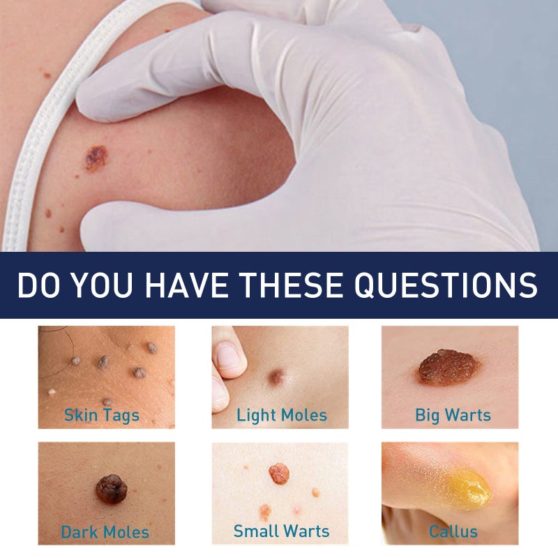 EELHOE 144PCS Skin Tag Patches Fast Healing Mole Wart Remover Waterproof Non-drying for All Skin Type - Image 3