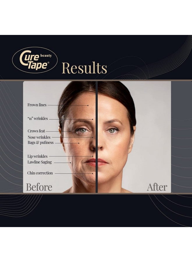 CureTape Beauty Kinesiology Tape | Anti-Wrinkle Face Tape | Face Lift Tape for Toning, Firming & Tightening The Skin | Kinesiology Tape for Face and Sensitive Skin | Soft on The Skin (2'' X 16') - Image 3