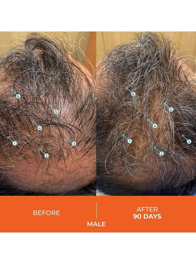 DS LABORATORIES DS Laboratories Revita Hair Growth Conditioner for Fine & Thinning Hair, Biotin Treatment for Hair Regrowth, Thickening & Loss Prevention  - Image 3
