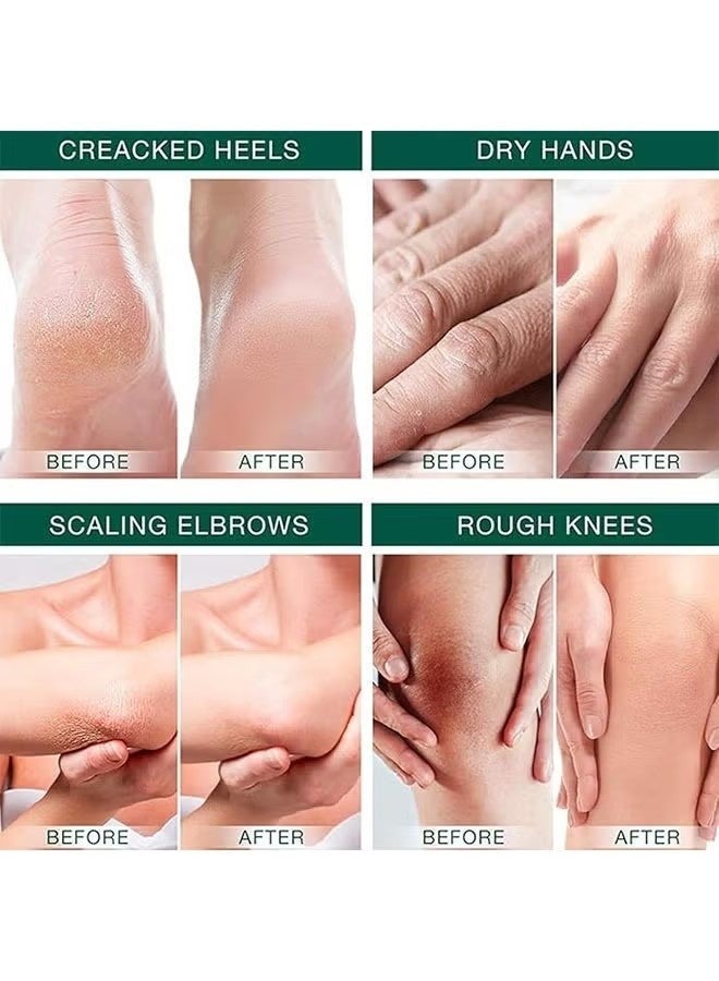 CANAMIN 40 Percent Urea Cream 150g, Intensively Moisturize And Nourish The Hand And Feet Skin, Urea Foot and Hand Cream for Dry Cracked - Image 5