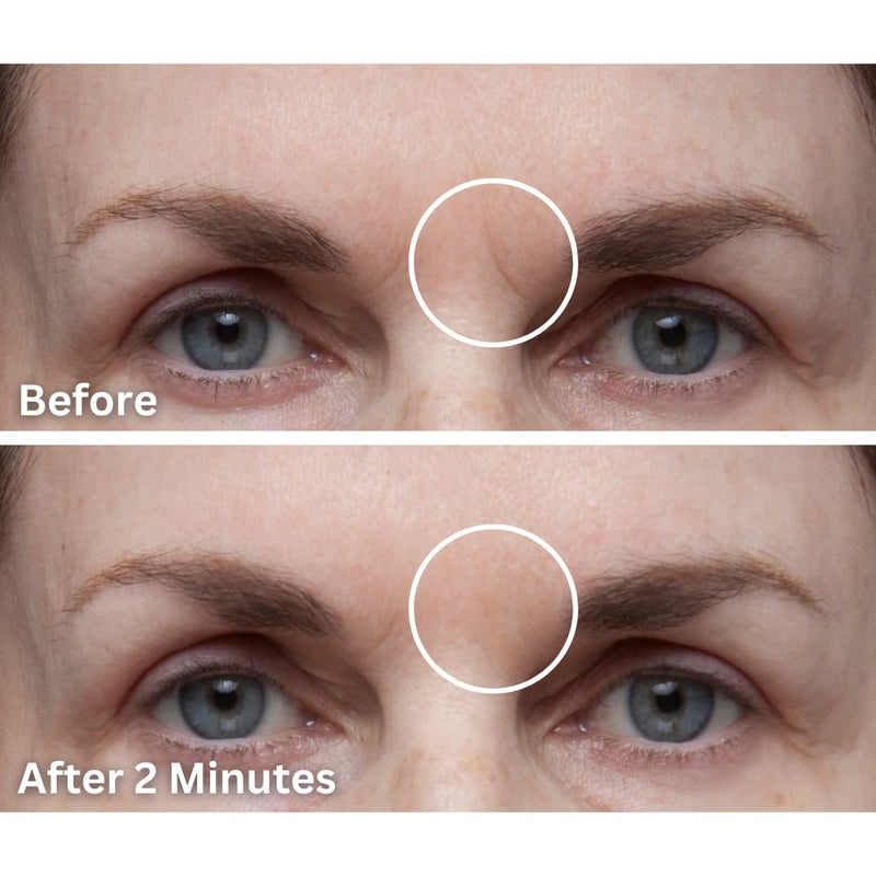 Dermaflage Scar Filler, Refill Applicator - Image 3