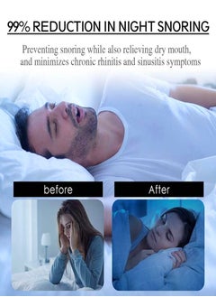 EELHOE 30 Pcs Stop Snoring Breathe Easier Patch Super Anti Snoring Solution For Men And Women Clear The Way To Breathe Better Air Reduce Snoring Relieve Nasal Congestion Caused By Colds And Allergies  - Image 5