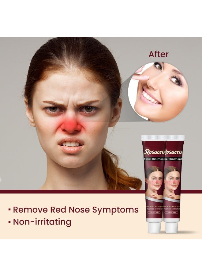 Rosacea Care كريم علاج الوردية للوجه تخفيف احمرار الأنف احمرار حب الشباب 30غ - Image 4