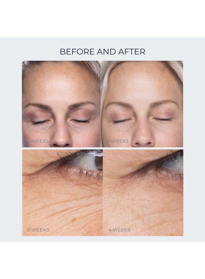 Alana Mitchell Antiaging Peptide Under Eye Cream Peptide Eye Cream For Hydrated & Firm Skin Under Eye Cream For Dark Circles And Puffiness Anti Aging Eye Cream For Crows Feet & Fine Lines (0.5 Oz/15 Ml) - Image 5