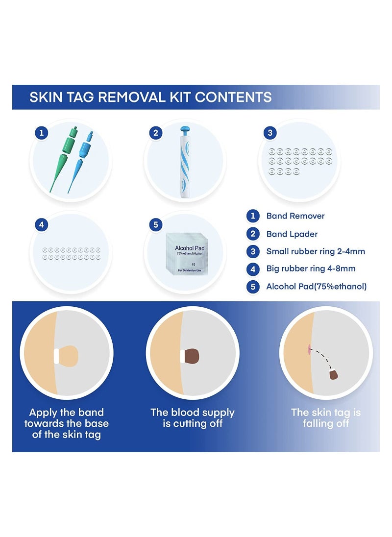 2 in 1 Skin Tag Remover Device Kits,for 2-8mm Tags,2 in 1 Skin Tag Remover Wart Removal with 40 Micro and Regular Skin Tag Bands