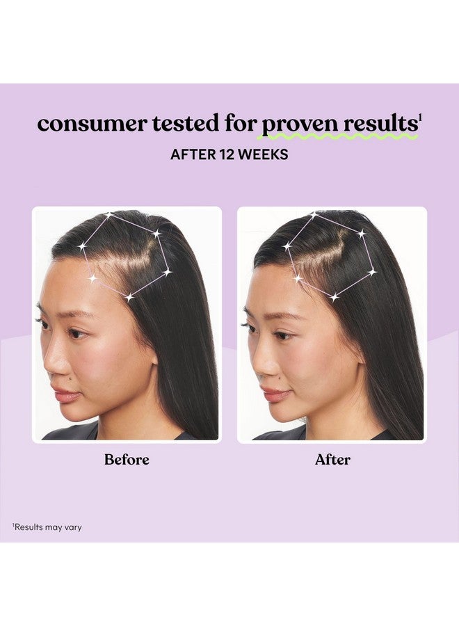 Lemme مكمل ليم مي جرو لنمو الشعر للنساء، معقد الكيراتين المثبت سريرياً لشعر أكثر كثافة وغطاء لفروة الرأس، تقليل تساقط الشعر، تغذية الشعر الخفيف - إمداد لمدة شهر واحد - Image 3