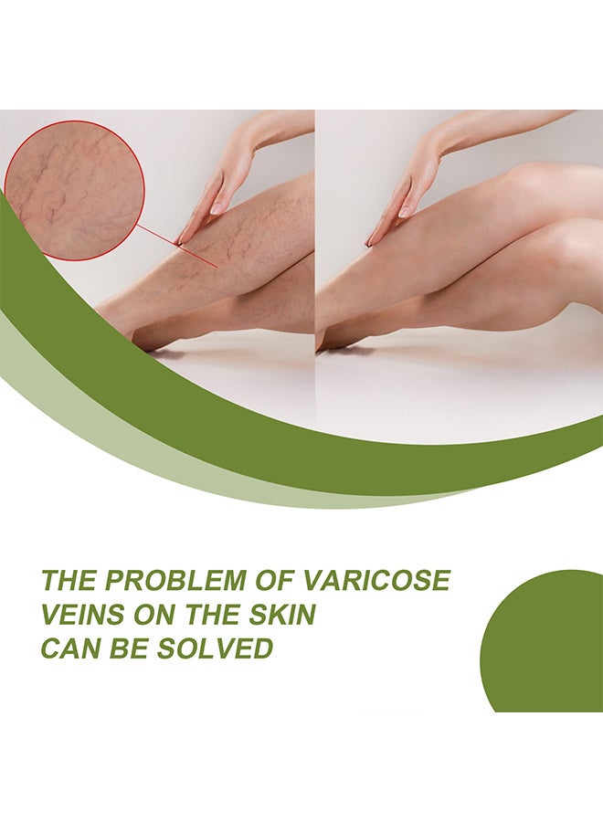 EELHOE Varicose Veins Cream, Spider Veins Repair Cream for Legs, Varicose & Spider Vein Treatment, Leg Cream for Soothing and Repair (50g) - Image 3