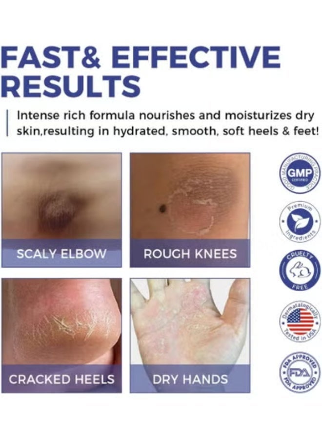 أوكييا كريم يوريا ٤٢٪ بالإضافة إلى حمض الساليسيليك ٢٪ للقدمين واليدين، لعلاج تشققات اليدين والكعبين والمرفقين والقدمين - يُخفف من جفاف القدمين، ١٥٠ غرامًا. - Image 4