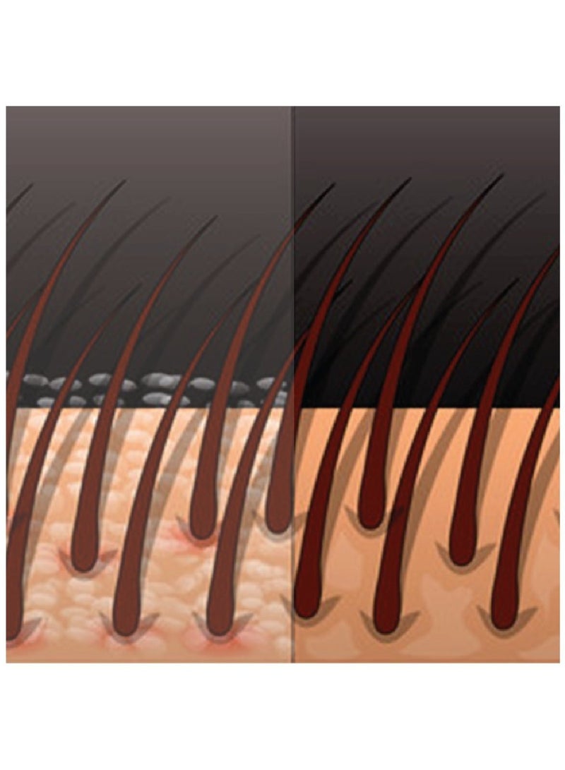 فيجيتال نوريشر 120 مل. -جل بلسم طبيعي 100٪ بلسم طبيعي لحماية اللون لتغذية الشعر وفروة الرأس للشعر الجاف والتالف - Image 2