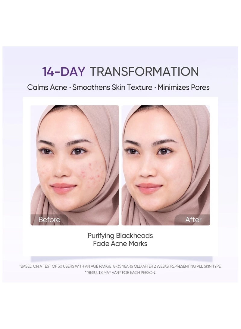 SKINTIFIC Lactic Acid Skin Renewal Exfoliating Serum Acne Treatment Pore-Tightening 20ml  - Image 4