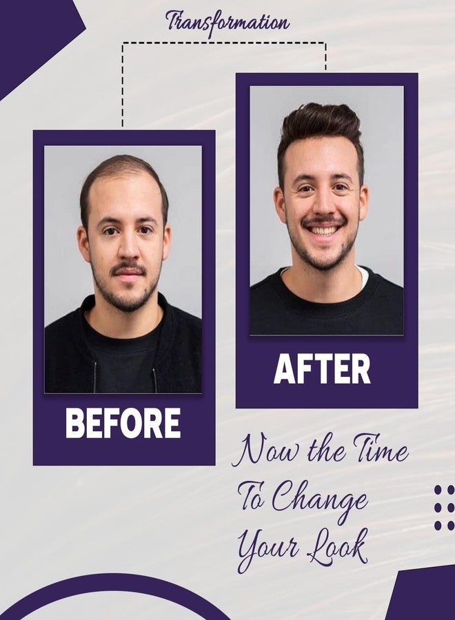 غلان شعر مستعار من GLAN، قطع شعر بشري، أنظمة استبدال الشعر للرجال والفتيان لتغطية مناطق الصلع بشريط أصفر صغير ومشابك تمديد، لون بني أسود طبيعي، عبوة من قطعة واحدة (رقعة أحادية الخيوط، 10 × 7). - Image 4