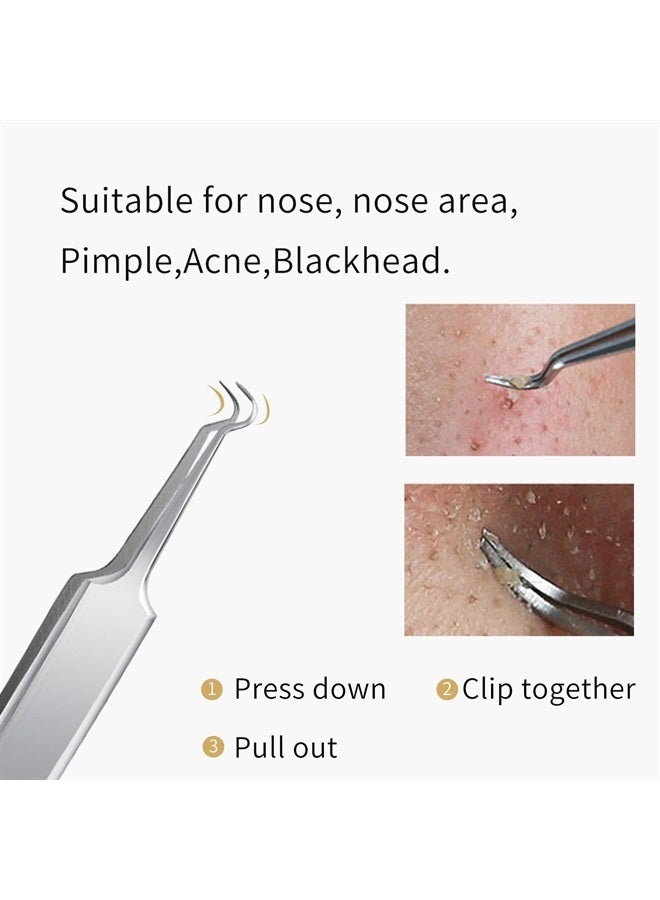 FIXBODY Blackhead and Splinter Remover Tools - Stainless Steel Professional Easily Cure Pimples Whiteheads Comedones Acne Zit Ingrown Hairs and Facial Impurities Bend Head Tweezer Surgical Kit - Image 3