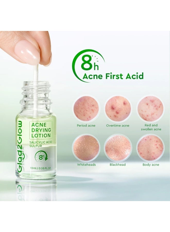 Glad2Glow Acne Drying Lotion Calms Acne Treatment Salicylic Acid Pimple Acne Patch Scar Dark Spot Package of 2 - Image 2