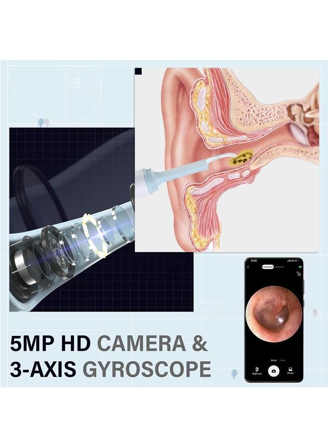 Arabest Ear Wax Removal, Ear Scope Earwax Cleaner Tool Kit, with 1080p Fhd Wireless Waterproof Ear Camera, for Iphone, Ipad and Android（white)  - Image 2