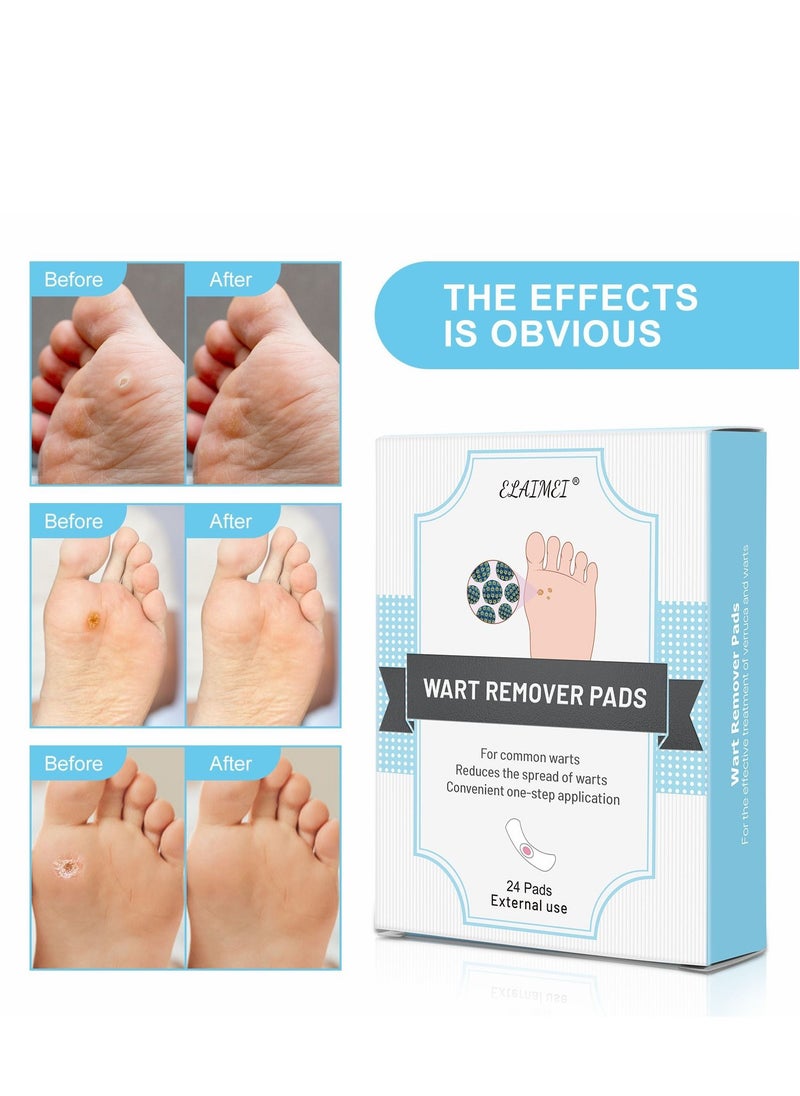 Elaimei 24 Pieces Corn Stickers Foot Stickers Painless To Wart Calluses Foot Calluses  - Image 2