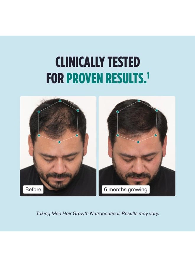 NUTRAFOL مكمل نمو الشعر للرجال وسيروم الشعر، مختبر سريرياً لزيادة السمك والقوة المرئية - إمداد لمدة شهر واحد، زجاجة 1.7 أونصة سائلة - Image 3