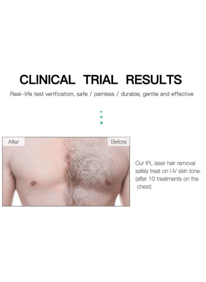 Loquat Household full body permanent hair removal device, laser hair removal equipment, permanent painless hair removal device suitable for men and women - Image 5