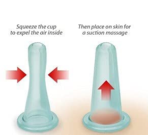 ACS Facial Cupping Set Silicone Suction Massage Cups Acupuncute Manual Therapy Face Massger, Transparent, Set of 2 - Image 2