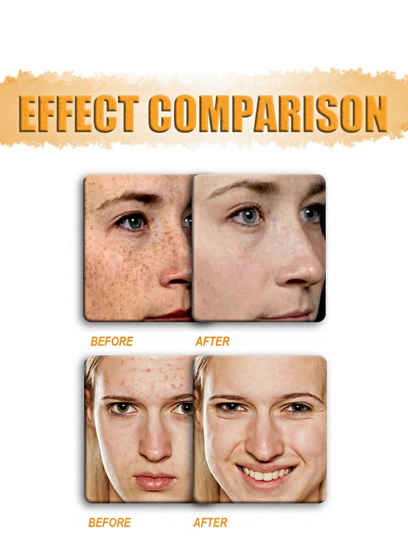 EELHOE Kojic Acid Dark Spot Remover Soap Bars with Vitamin C, Retinol, Collagen for Hyperpigmentation, Moisturizing & Nourishing - Image 5