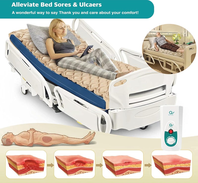 Q DEVICES Anti-Decubitus Anti-Bedsore Air Mattress 1 Year Replacement Warranty, Beige - Image 5