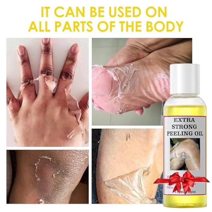 YAFUSIPE Yellow Peeling Oil for Dark Skin Strong Peel Oil Extra Strength Exfoliating Chemical Exfoliant Peels Solution at Home Body Peeling for Exfoliate Body Hand Foot Knuckle All Skin Type 3.66 OZ - Image 2
