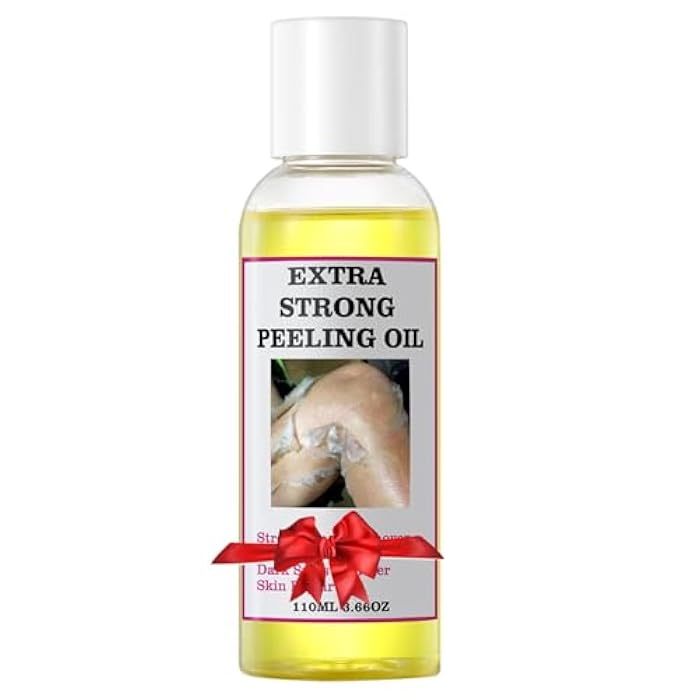YAFUSIPE Yellow Peeling Oil for Dark Skin Strong Peel Oil Extra Strength Exfoliating Chemical Exfoliant Peels Solution at Home Body Peeling for Exfoliate Body Hand Foot Knuckle All Skin Type 3.66 OZ - Image 1