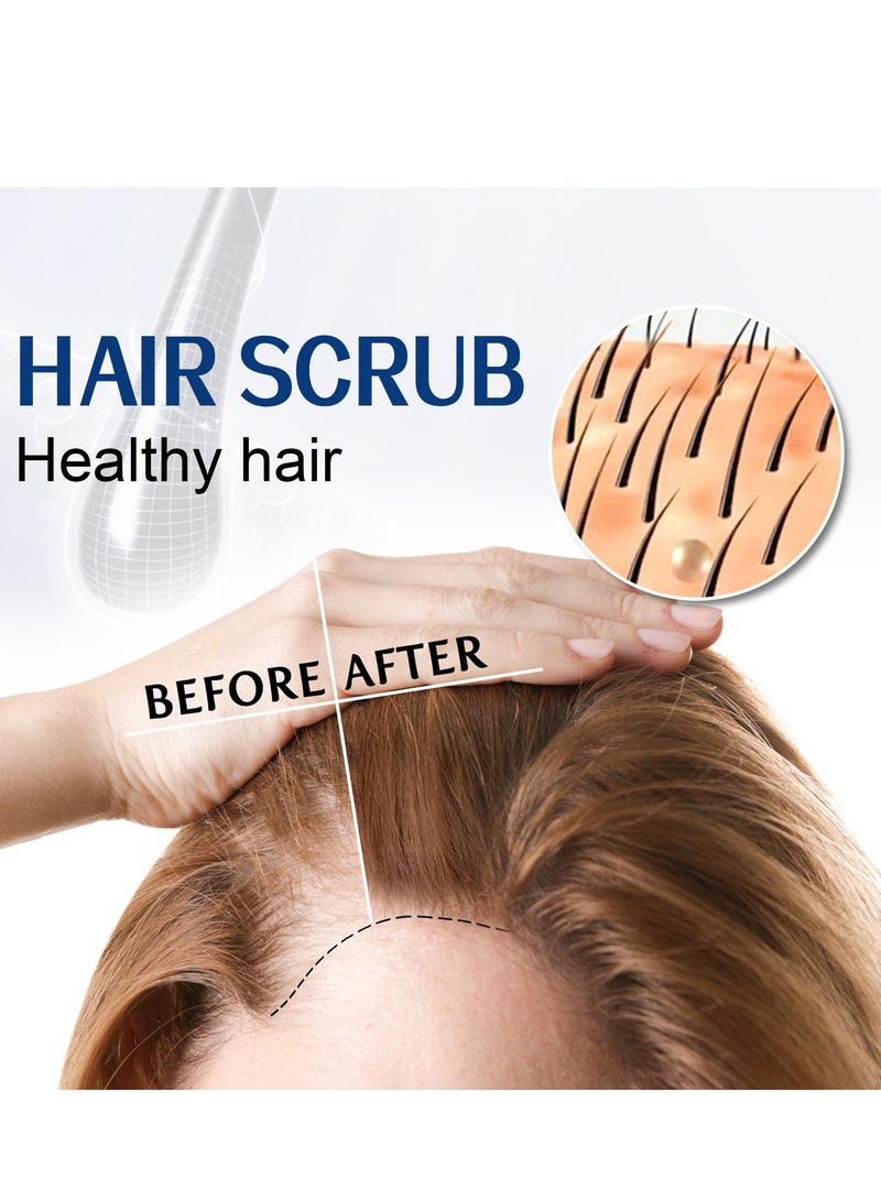 EELHOE Exfoliating Scalp Scrub, Dandruff Itch Treatment, Hair Detox Scrub, Sulfate-Free Scrub Soothes Dry, Flaky, Itchy Scalp, Removes Buildup - Image 2