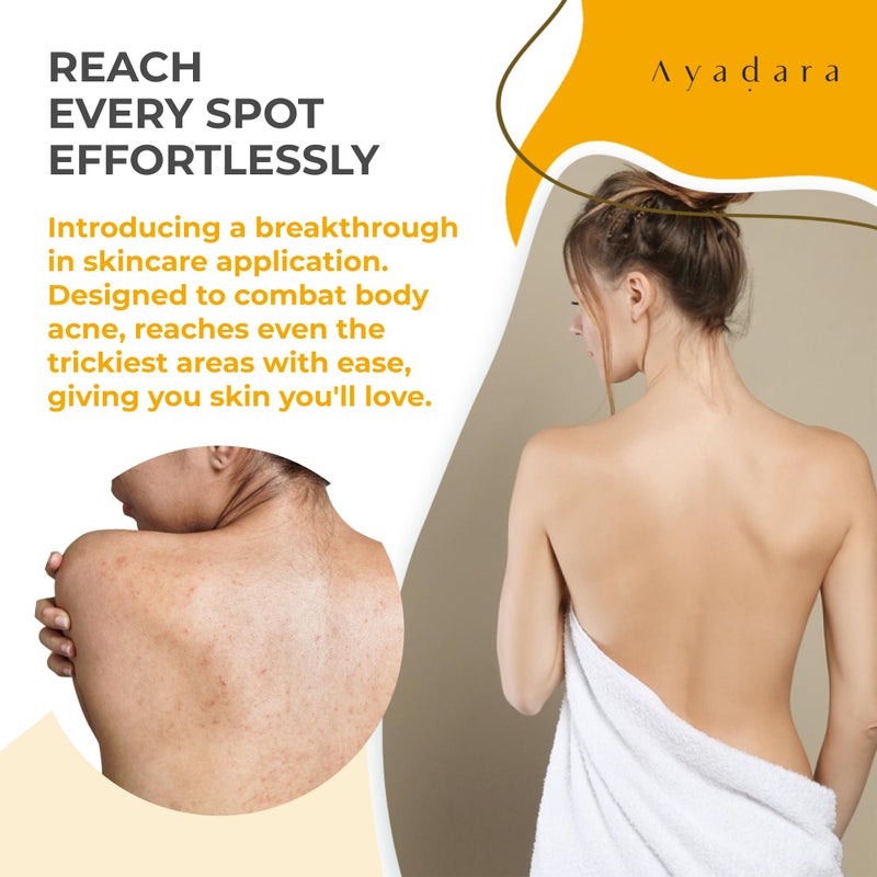 AYADARA Acne Body Spray with 2% Salicylic Acid, Back & Body Acne, Cystic Back Acne Spray Chest, Butt and Body Acne for Hormonal, Bacne for Teens Adults, 3-Pack - Image 2