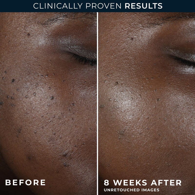 RoC Multi Correxion 5 in 1 Restoring, Anti Aging Night Cream for Face with Hexinol, 1.7 Ounces (Packaging May Vary) - Image 5