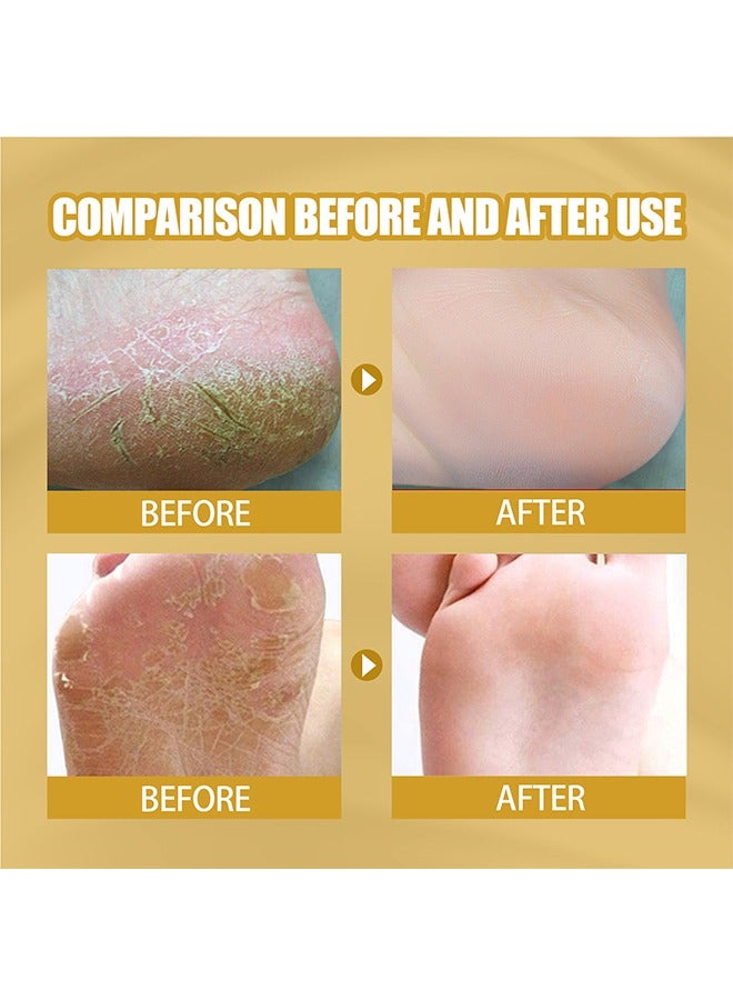 EELHOE Cracked Skin Banana Repair Cream, cracked feet, elbows, knees, black skin to be smooth, soft and moisturized with banana extract and vitamin E 20g - Image 2