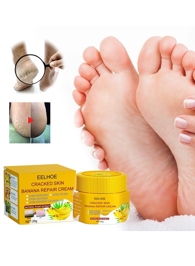EELHOE Cracked Skin Banana Repair Cream, cracked feet, elbows, knees, black skin to be smooth, soft and moisturized with banana extract and vitamin E 20g - Image 1