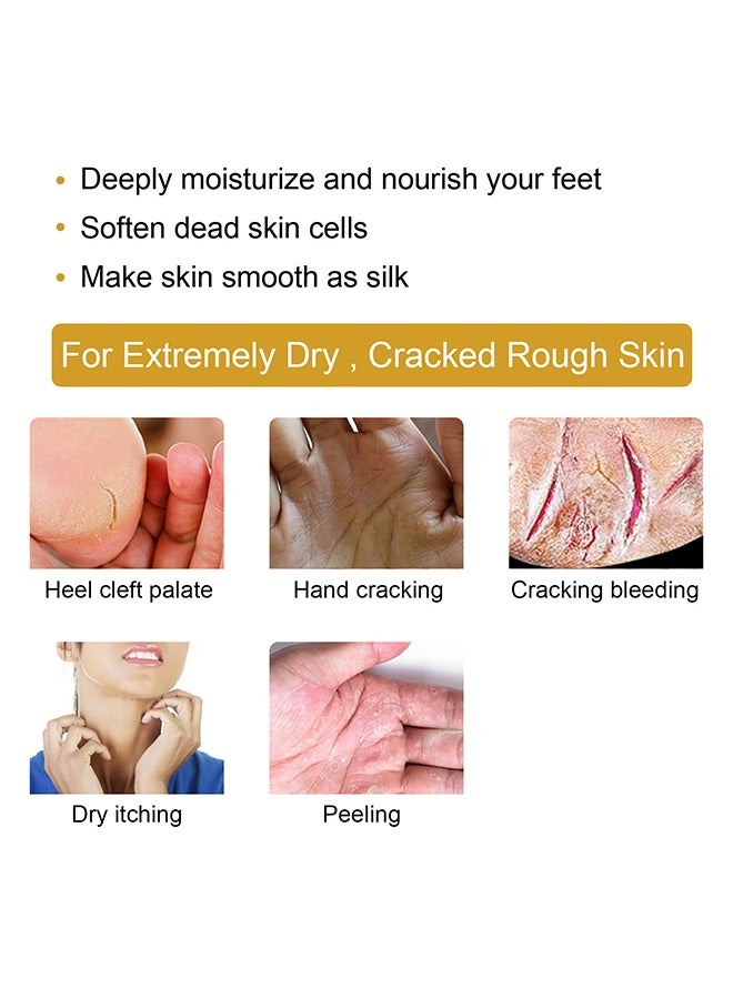 EELHOE Cracked Skin Banana Repair Cream, cracked feet, elbows, knees, black skin to be smooth, soft and moisturized with banana extract and vitamin E 20g - Image 4