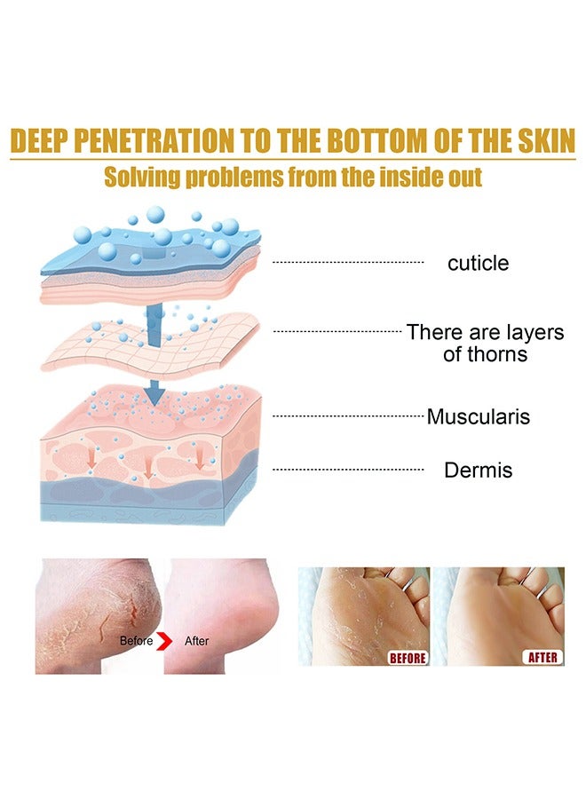 EELHOE Cracked Skin Banana Repair Cream, cracked feet, elbows, knees, black skin to be smooth, soft and moisturized with banana extract and vitamin E 20g - Image 5