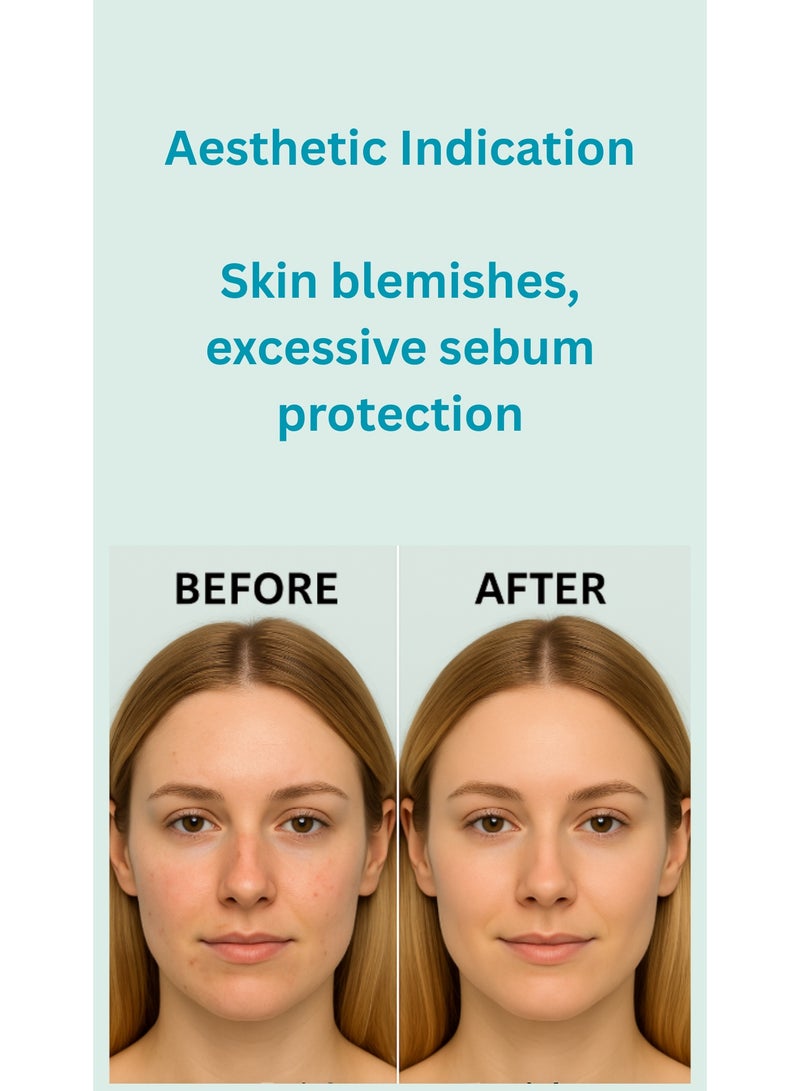 ®بونیتو التحكم في التوازن - Image 3