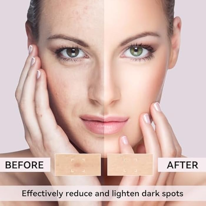 DMYGO Dark Spot Remover for Face, Dark Spot Corrector for Age Spot Sun Spot Brown Spot Melasma Uneven Skin Tone, with Vitamin C and Hyaluronic Acid for Women and Men, 1.7 FL OZ - Image 3