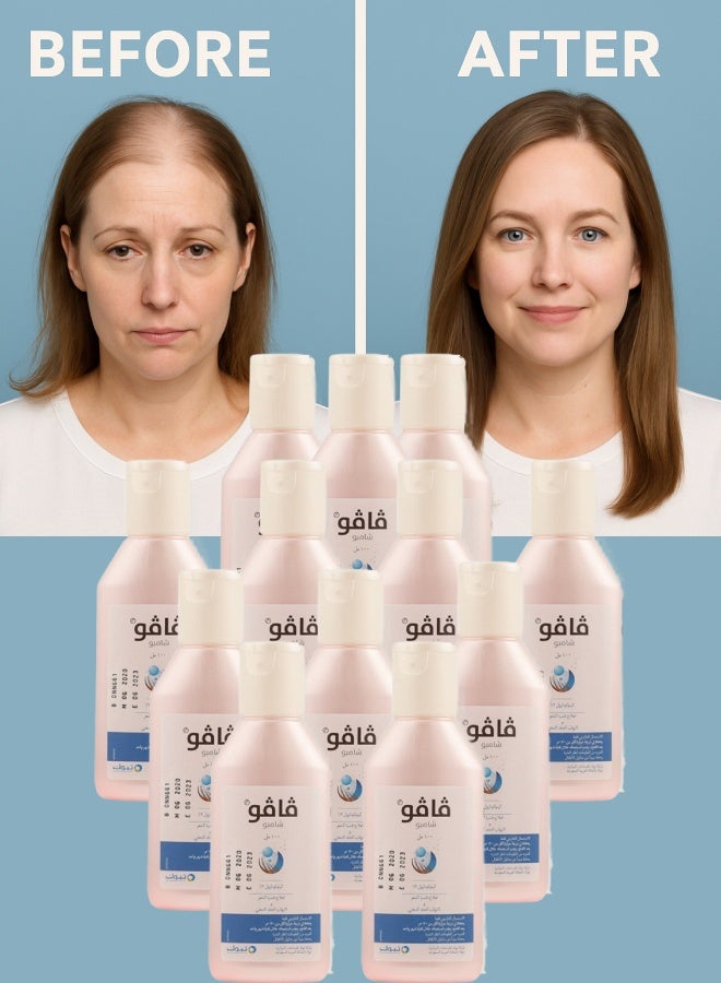 فافو 12 قطع فافو 2% شامبو 100مل - Image 1