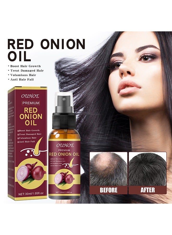 OUHOE Red onion Oil，Onion Hair Oil Rapid Growth Hair Treatment 7 Day Hair Growth Serum Essence Oil Regrow,  Stop Hair Loss Hair, Thinning Treatment Hair Growth Oil for Women & Men 30ML  - Image 5