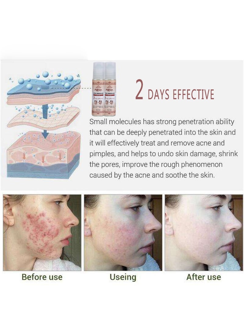 Collagen Collagen Plus Vit C, E Acne and Acne Scars Removing Face Serum 15ml  - Image 4