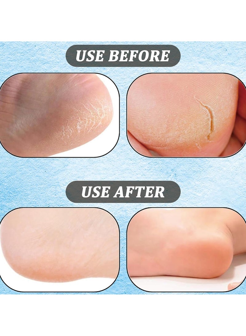 Silicone Moisturizing Socks Reusable Foot Pedicure Silicone Socks Heel Protector Foot Spa Socks for Repairing and Moisturizing Suitable for Women and Men - Image 4