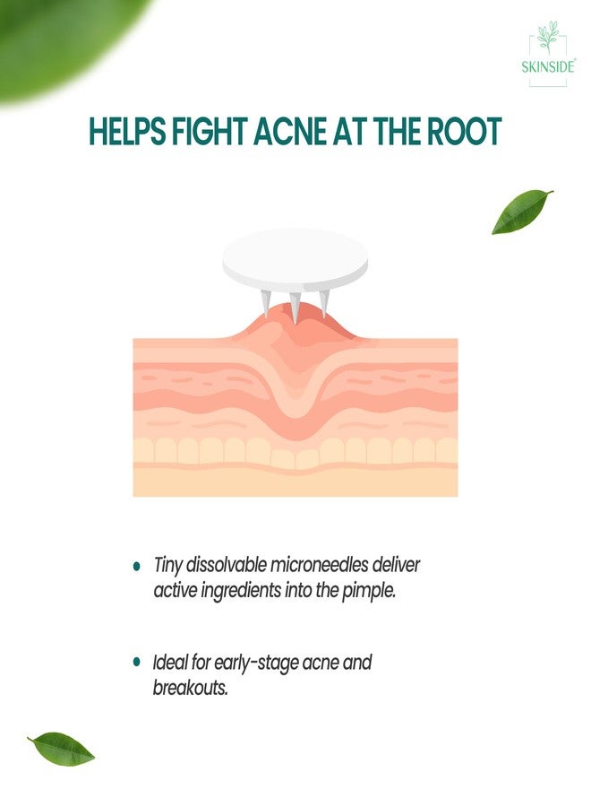 SKINSIDE Microneedle Acne Patches (9 Patches) | 300+ Self-Dissolving Microneedles | Salicylic Acid + Hyaluronic Acid | Overnight Pimple Patch for Deep & Early Pimples | Fast Acne Relief - Image 3