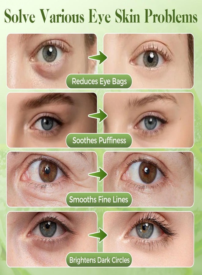 Nexkayee Aloe Vera Under Eye Patches for Dark Circles, Puffiness Relief, Hydrating Hydrogel Mask, Moisturizing Gel Pads for Bags and Tired Skin - Image 4