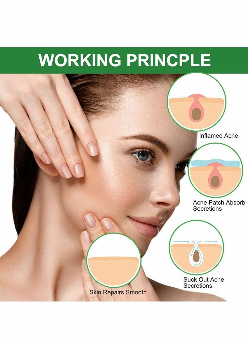 SYOSI Acne Pimple Patches Acne Spot Treatments Hydrocolloid Patches, Acne Treatment Acne Care, Drug-free Non-drying, Invisible Spot & Blemish Acne Stickers 120 Patches  - Image 4