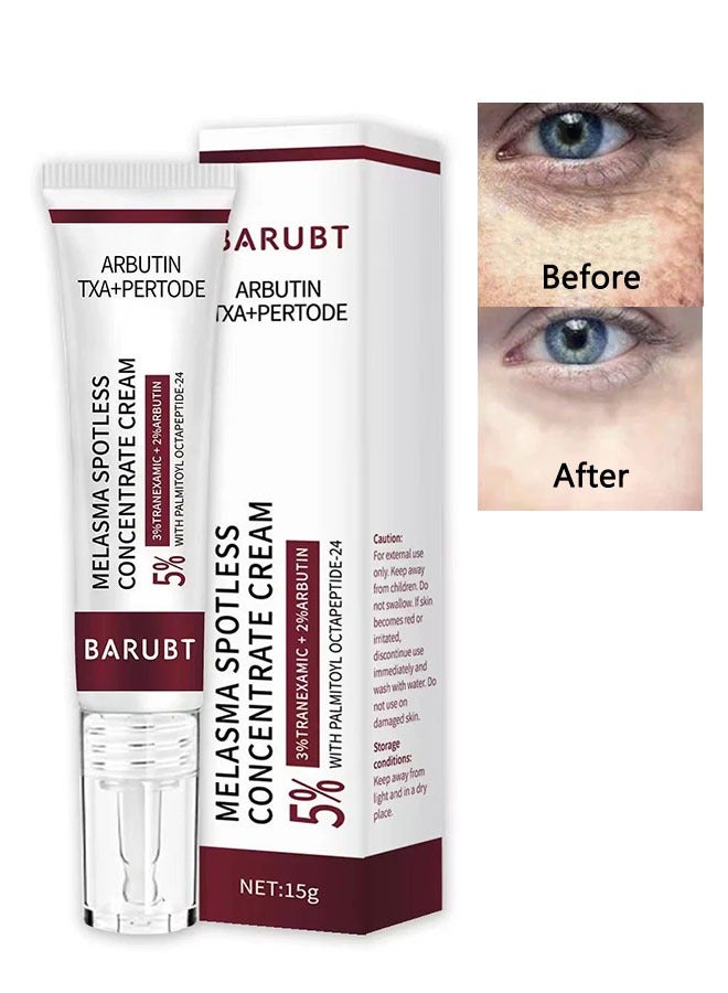 BARUBT Melasma Spotless Concentrate Cream 15g, Moisturizing Hydrating and Firming Cream for Dark Spot, Melasma, Age Spots, Freckle Remover Cream, Reduce Dark Circles and Fine Lines - Image 1