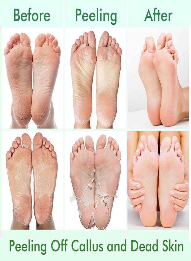 CMWGKBC 5 Pack Foot Peeling Mask,Exfoliator Peel Off Calluses Dead Skin Callus Remover,Foot Mask for Dry Cracked Feet,Foot Peel Masks for Men and Women Feet Peeling Mask for Fathers Mothers Day Gifts - Image 4