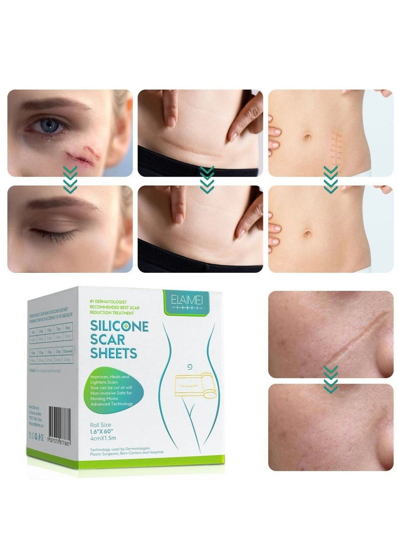 Generic Silicone Scar Sheets, Fade Scar Sticker, 4cm*1.5m, Efficient Beauty Scars Removal Self-adhesive Acne Burn Repair Soft Silicone - Image 2