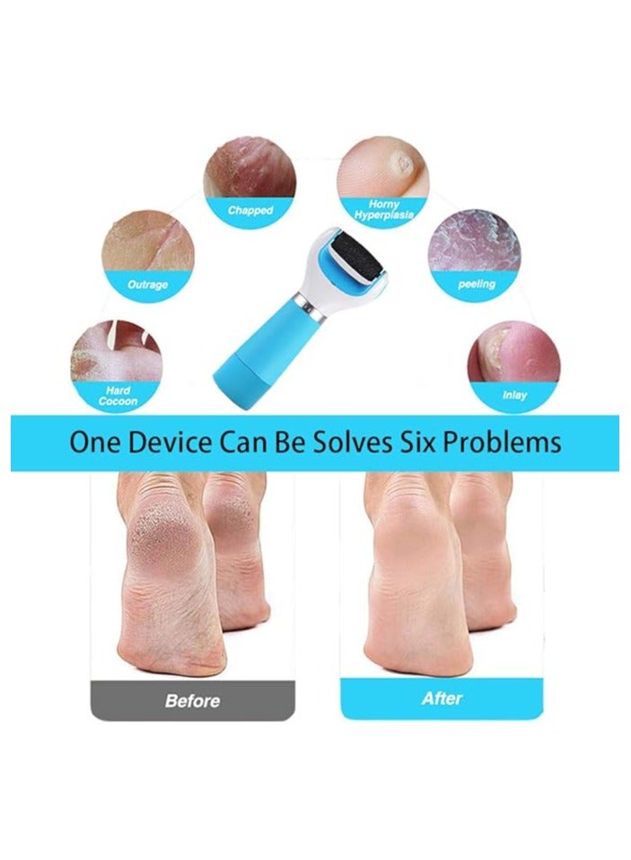 Electric Foot File, Pedicure Tools for Smoother Heels, Dry Feet and Dead Skin - Image 3